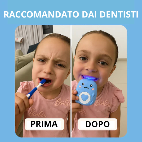 Spazzolino Ultrasonico - Pulizia a 360°